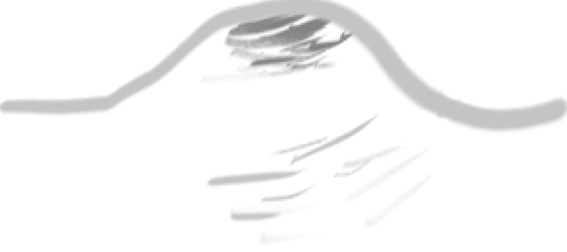 色素性母斑(ほくろ)
