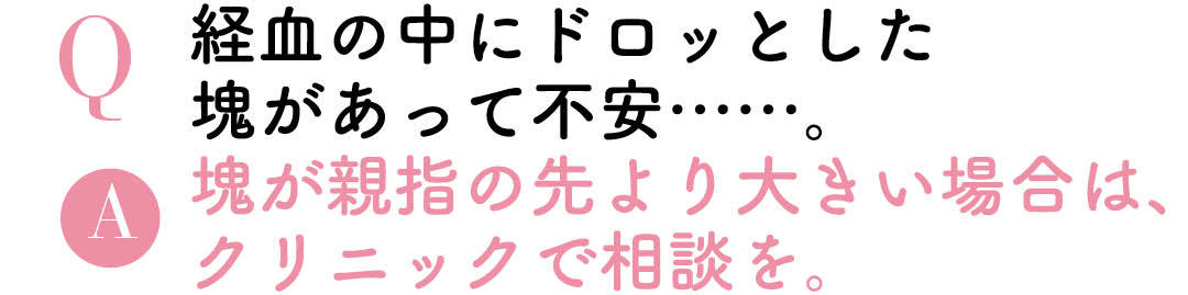 Q経血の中にドロッとした塊があって不安……。A塊が親指の先より大きい場合はクリニックで相談を。