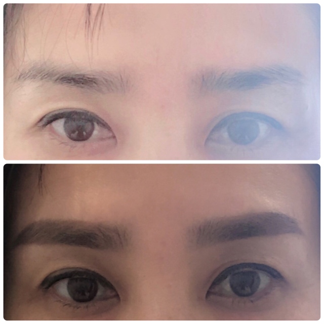上がbefore 下がafter