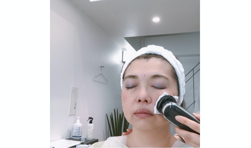 ヤーマンのFACELIFTGYMでの美顔器による施術