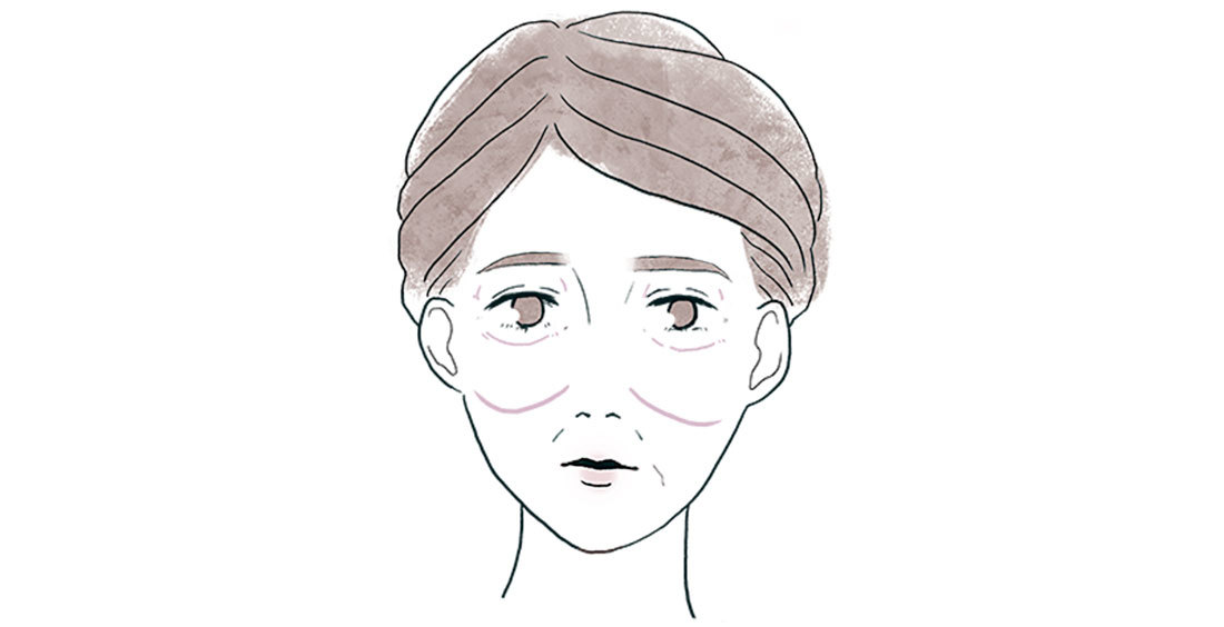 アラフォーの顔の〝たるみ〞2_4