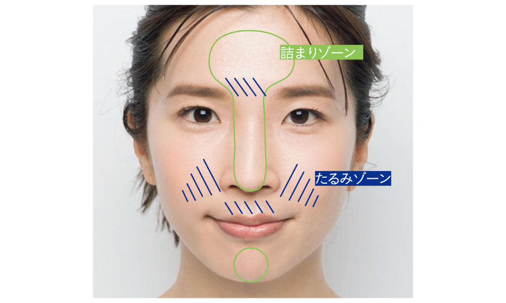.眉間や鼻の下の毛穴が目立つようになってきた…
