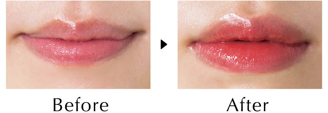 Before After