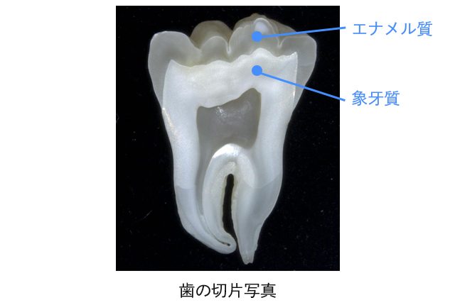 歯と歯ぐきを守る「アパデント」の特徴とは?