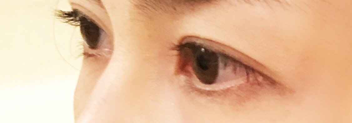 老け顔の犯人はまつげ⁉︎ 〜アラフォーからはじめたい!美容医療 まつげ編〜_1_3