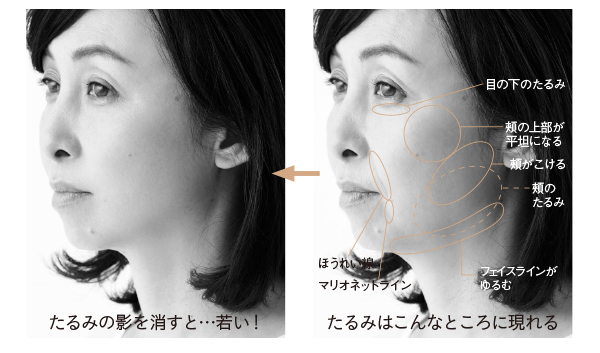 意識すべきはナナメ45°!他人目線に気づくための「顔たるみ」チェック表_1_3
