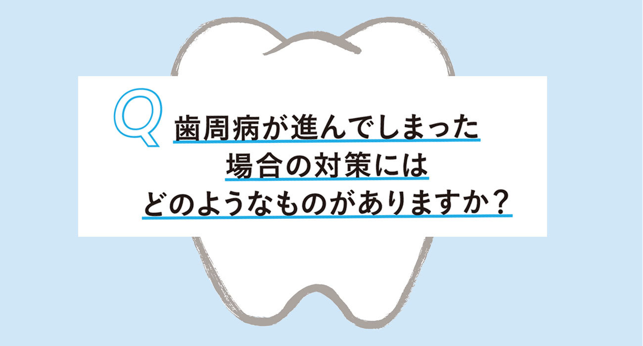 歯と歯茎の知っておきたいQ&A3