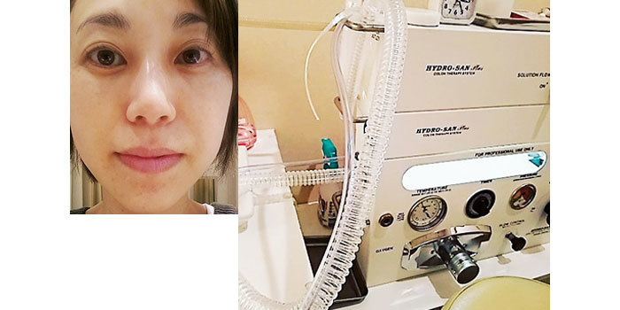 マリソル美女組のキレイの真実「SNS美人」「クリニック美人」_1_5