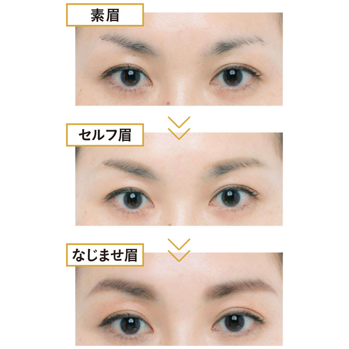下側が生えてこない_9