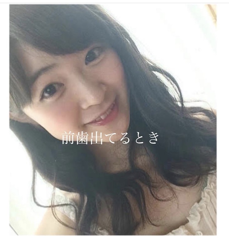 歯科矯正の話 やっと終わりました Non No Web ファッション 美容 モデル情報を毎日お届け