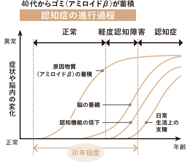 脳に散らばったゴミが「記憶の取り出し」をじゃまする