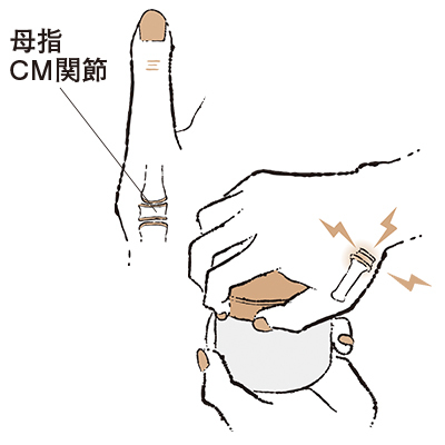 6. 親指のつけ根が痛い“母指CM関節症”【50代のお悩み・更年期の手指問題】_1_1