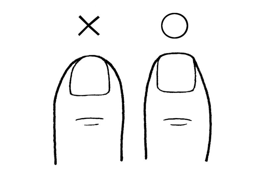 爪まわりのトラブルを防ぐための3つのルール_1_2