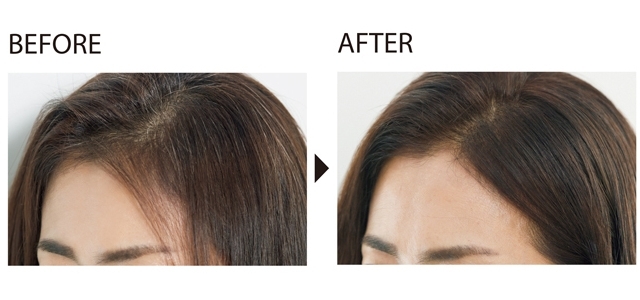BEFORE AFTER