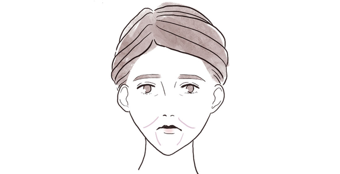 アラフォーの顔の〝たるみ〞2_3