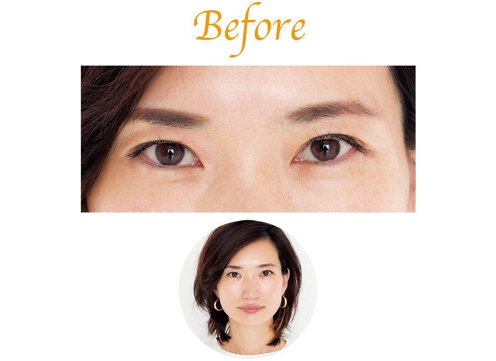 涼しげ目もとさんのbefore写真