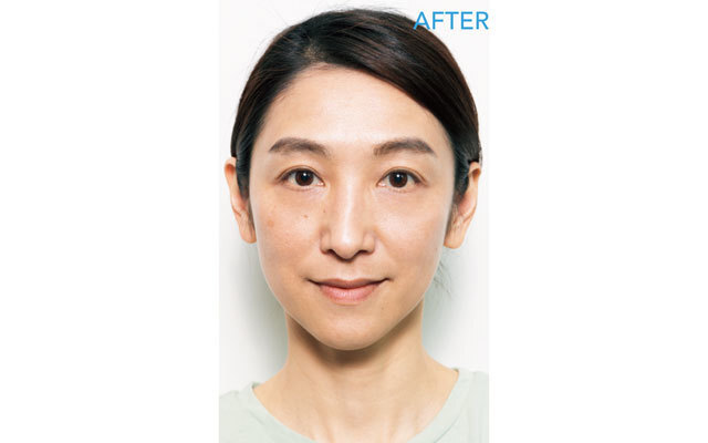 2週間でこんなに明るく!