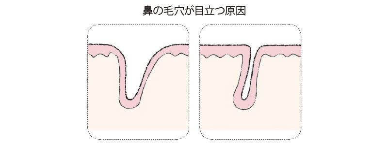 鼻も老けるって本当ですか_7