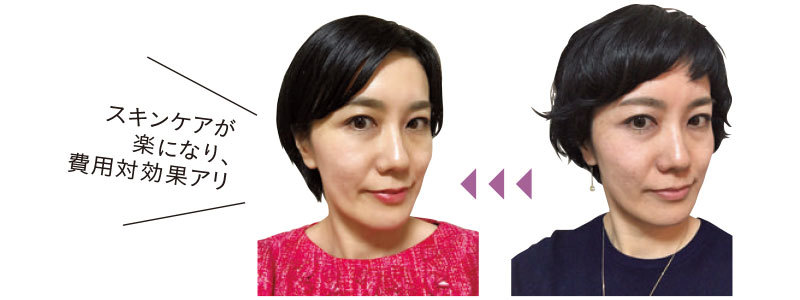マリソル美女組のキレイの真実「SNS美人」「クリニック美人」_1_4