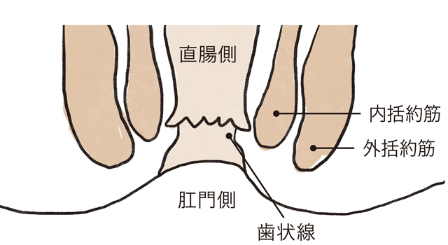 裂肛(切れ痔)