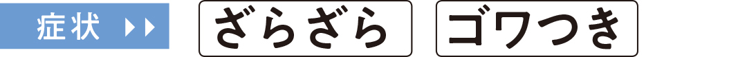 症状 ざらざら ゴワつき