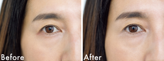 くすみをコンシーラーでオフしたBefore&After
