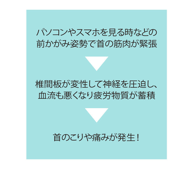 首のこりや痛みが発生する原因