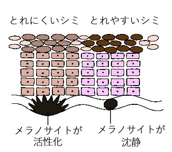 とれやすいシミととれにくいシミが混在